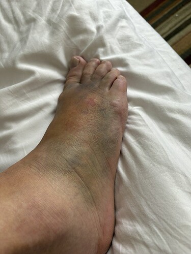 Foot day 4